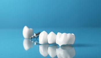 What are the Benefits of Dental Crowns for Restoring Damaged Teeth