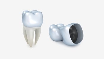 How Dental Crowns Can Boost Confidence and Oral Health in Port Orange